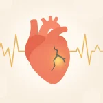 Heart Attack,